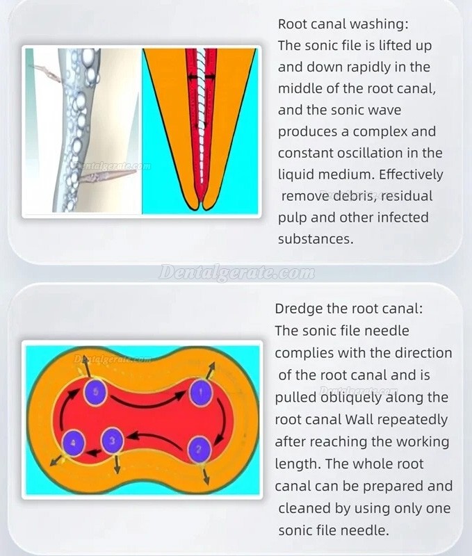 Dental Air Sonic Endo Handst&uuml;ck mit 2 Karton Endo Feilennadeln